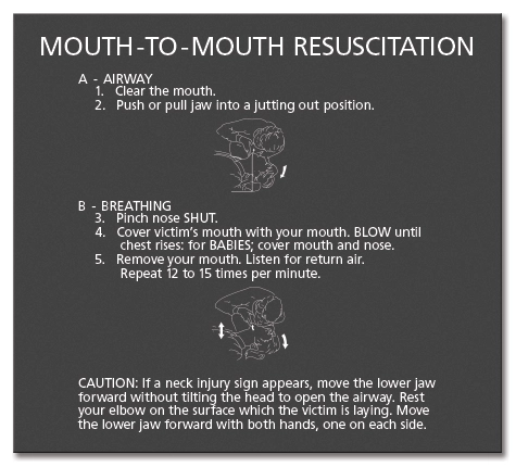 CPR Instructions Sign