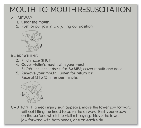 CPR Instructions Sign