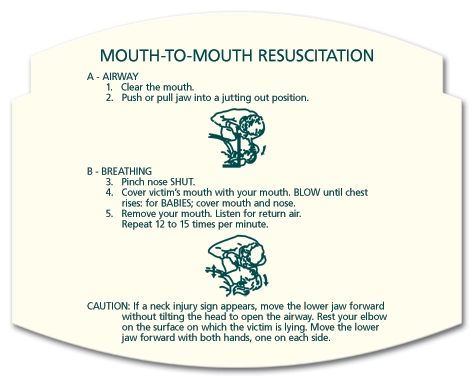 Mouth to Mouth Resuscitation Instructions